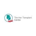 15-Hairtransplant-150x150